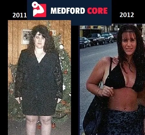 Before After Results